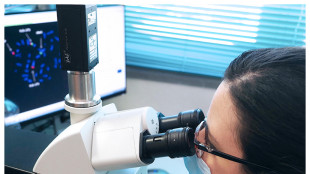 Nel sangue ci sono molecole-spia dell'invecchiamento