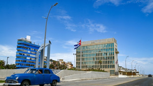 EEUU realiza los primeros pagos a v&iacute;ctimas del "S&iacute;ndrome de La Habana"