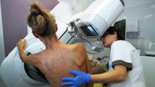 Brustkrebsvorsorge: Mammographie k&uuml;nftig auch f&uuml;r 70- bis 75-j&auml;hrige Frauen