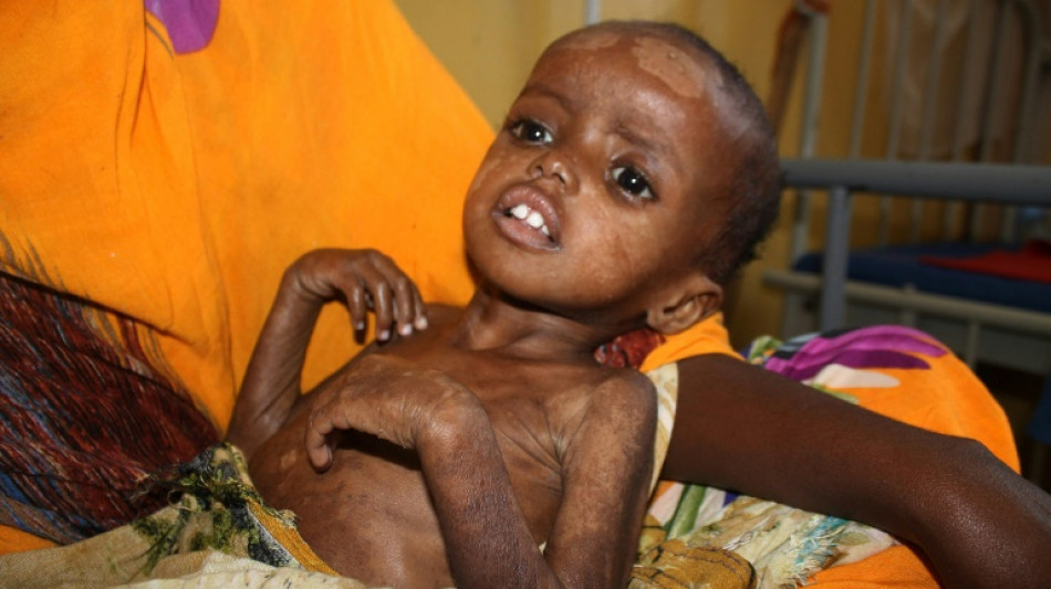 Agotados por el hambre, los ni&ntilde;os somal&iacute;es no tienen fuerzas para llorar
