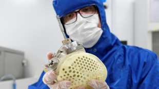 Coeur artificiel: Carmat obtient un nouveau délai pour tenter de trouver un repreneur